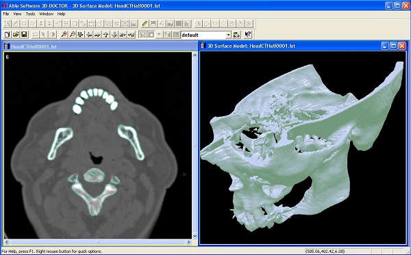 medical 3D model